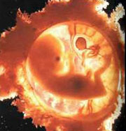 Стресс у эмбриона грозит болезнями сердца