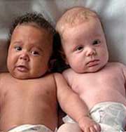 Почему в США рождается все больше близнецов