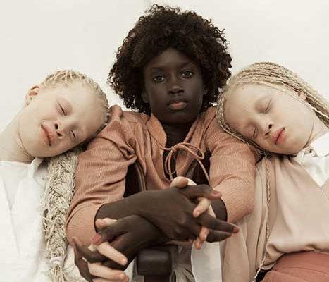 Близняшки-альбиносы — невероятный каприз природы — снялись для Nike и Bazaar Kids. Фото