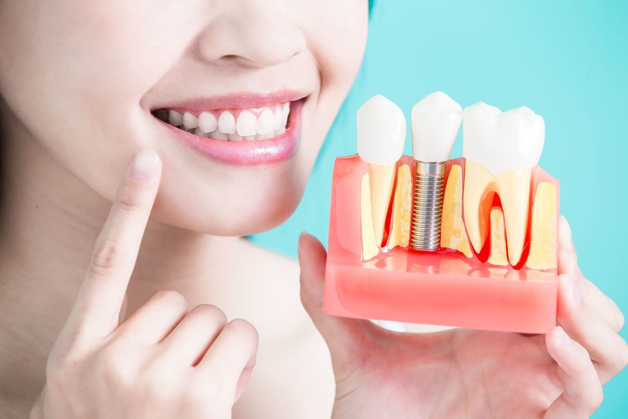 Реставрация и протезирование зубов: отличия и сходство