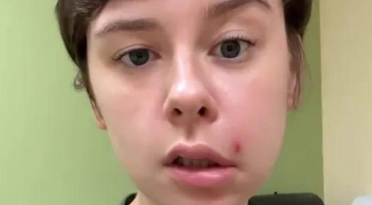 Давите прыщи на лице? Помните про треугольник смерти