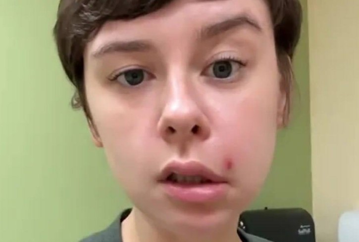 Давите прыщи на лице? Помните про треугольник смерти