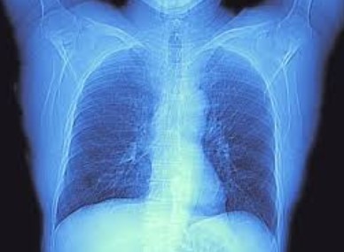 В каких случаях КТ грудной клетки является срочным и обязательным