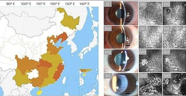 Любители японской кухни могут… ослепнуть